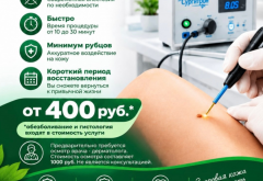 Удаление родинок, кератом, папиллом и бородавок радиоволновым методом («Сургитрон»)